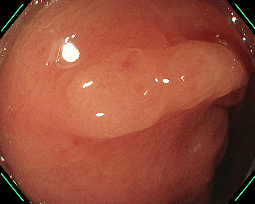 Medical Image A