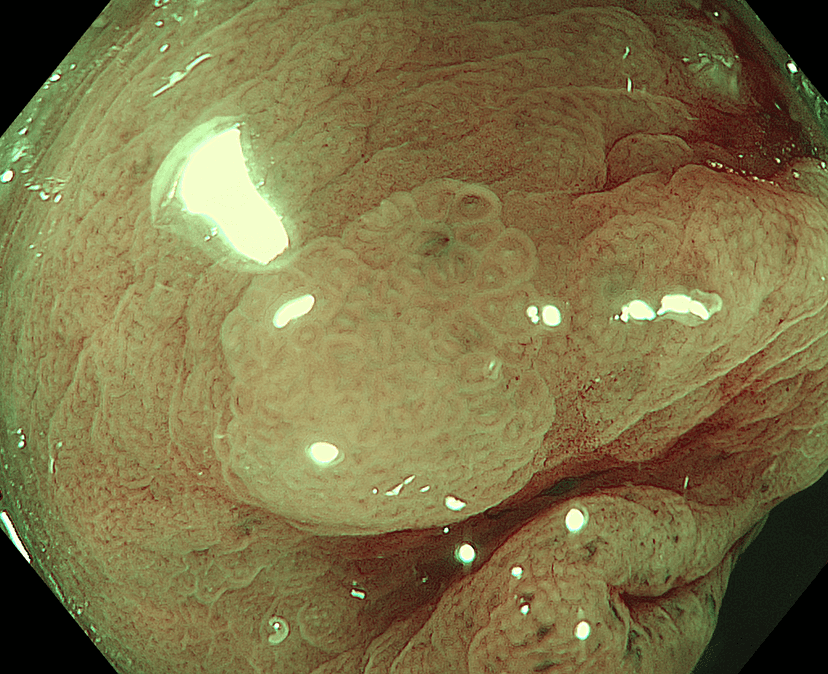 Medical Image B